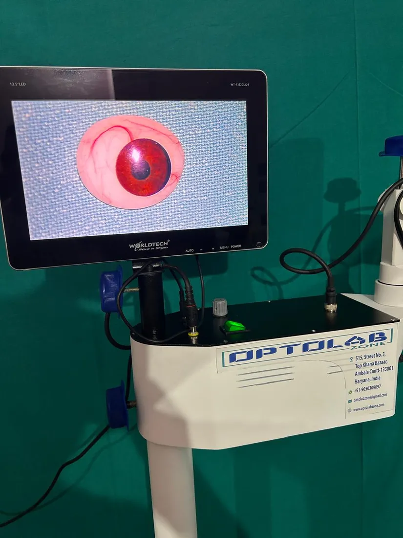Ophthalmic Surgical Microscope photo 2